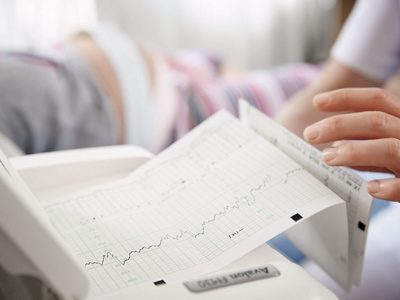 Hebamme misst mit Wehenschreiber die Abständer der WeEhen