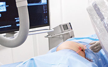 hirslandenn-beckenbruch-im-alter-1