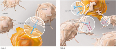 immuntherapie-skizze