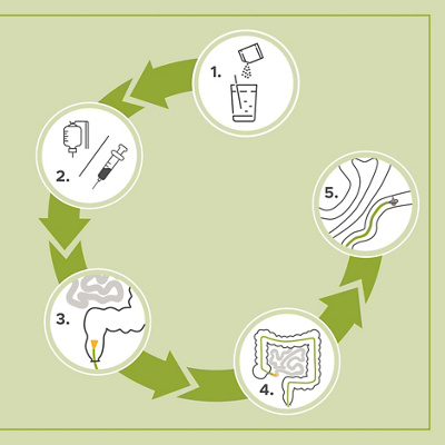 klinik-aarau-darmspiegelung-grafik