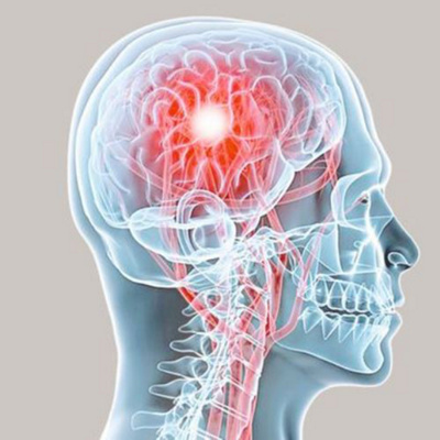 Illustration Kopf und Gehirn