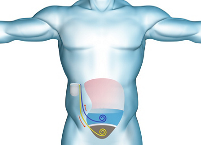 klinik-beau-site-hepatologie