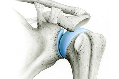 Illustration Schulter