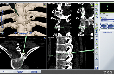 Bilderansicht brainlab spine der Klinik Stephanshorn