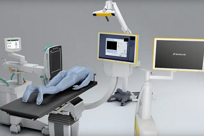 Illustration einer Wirbelsäulenoperation mit Brainlab