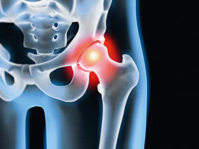 Hüftgelenk bei einem Skelett