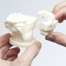 kniegelenkprothese_modell