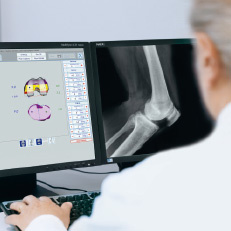 kniegelenkprothese_screen_arbeitsplatz