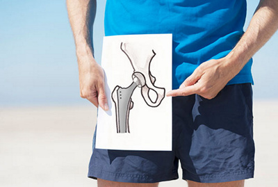 Drawing of a total hip-joint replacement. XXL size image.