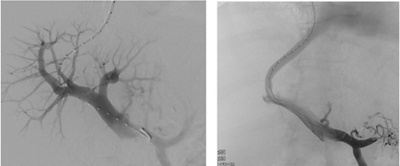 kurzschlussverbindung
