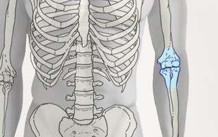 orthopaedie-zentrum-zuerich-ellbogen