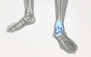 orthopaedie-zentrum-zuerich-fuss-und-sprunggelenk