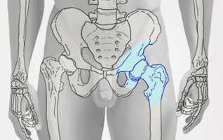 orthopaedie-zentrum-zuerich-huefte