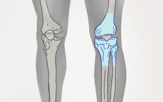 orthopaedie-zentrum-zuerich-knie