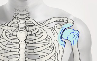 orthopaedie-zentrum-zuerich-schulter