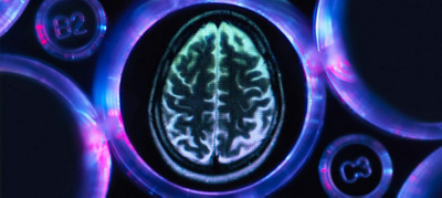 A pacemaker for your brain