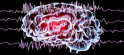 patients with epilepsy