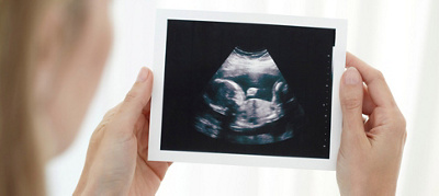 Do you need non-invasive prenatal testing?