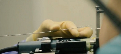 Accurate early diagnosis of prostate cancer