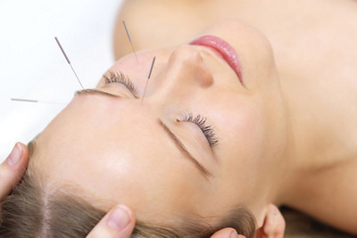 Acupuncture therapy - alternative medicine