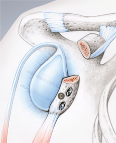 schulterstabilisierung_latarjet_2
