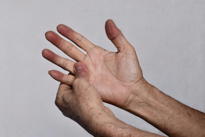 The hidden clues in a patient’s skin: What paramedics can see before you say a word