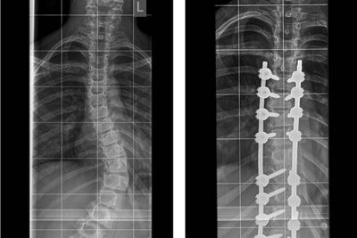 Spine