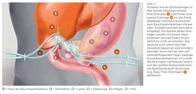 spueldrainagen_mittelpunkt