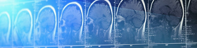 Neurochirurgie Zürich
