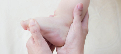 Step by Step: Treating clubfoot with the Ponseti Method