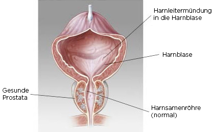prostata screening ab wann