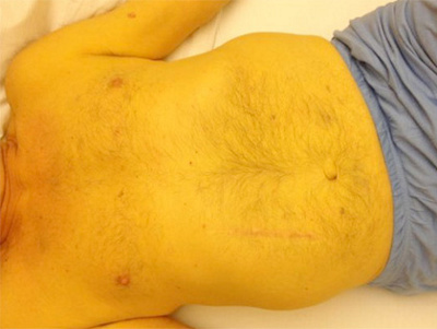 was-macht-die-leber-krank-2