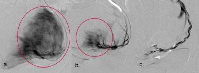 zentrum-fuer-mikrotherapie-resultat